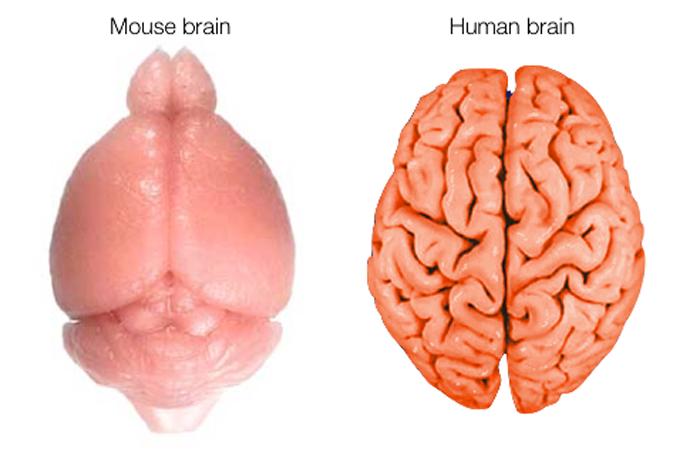 Modern human brain showing unique organization