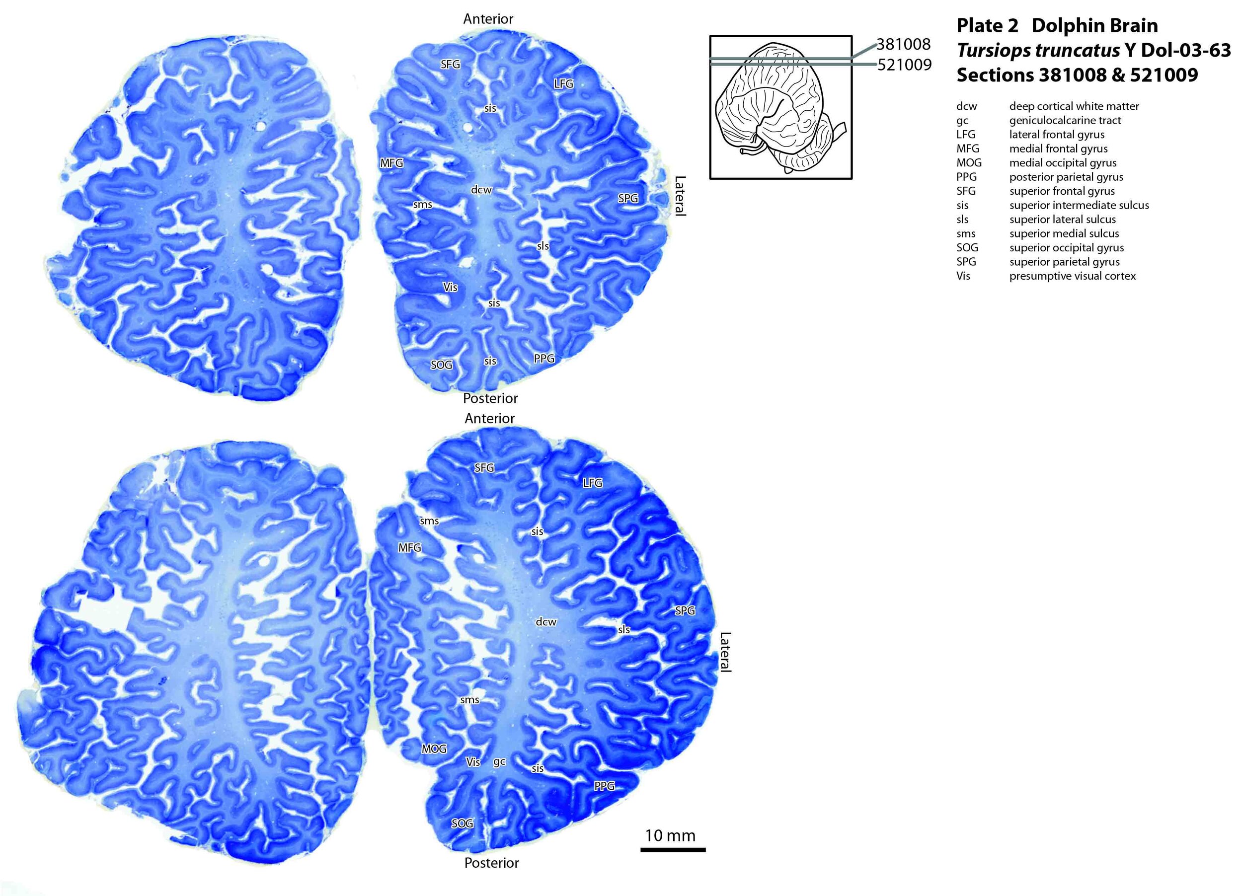 Dolphin brain showing extreme gyrencephalic folding