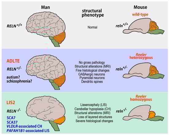 Rat brain showing smooth lissencephalic structure