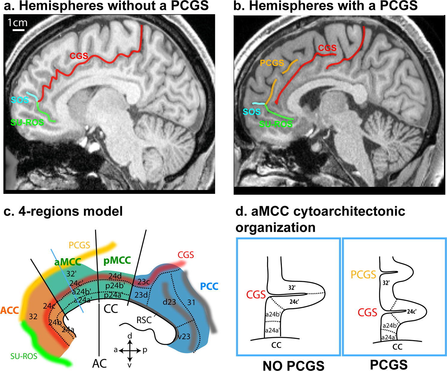 Early primate brain showing initial folding