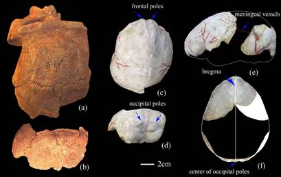Homo habilis brain showing Broca's expansion