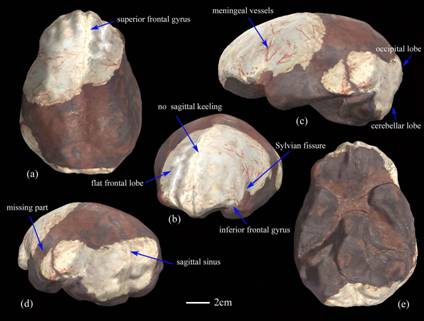 Homo erectus brain showing major expansion