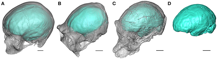 Early hominin brain showing bipedal adaptations